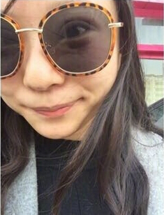 郑州都市风韵美容门诊做双眼皮开眼角果