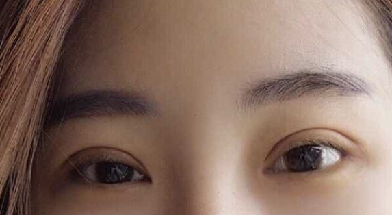 南京华美江宝华价格两万七做的眼部手术手术