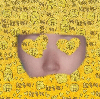 浙一徐靖宏医生做的硅胶隆鼻手术案例