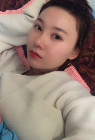 武汉美天医疗美容朱晓浩院长做的鼻部手术整形
