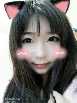 武汉同济医院王海平做的双眼皮变窄了怎么办?
