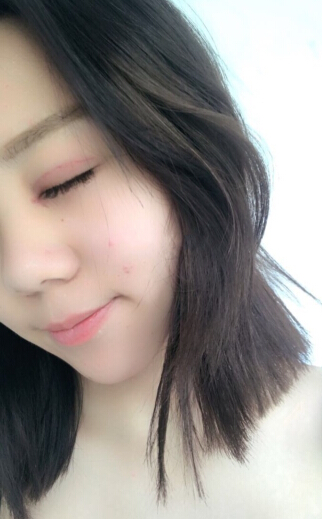 武汉美立方胡院长做的韩式三点修复