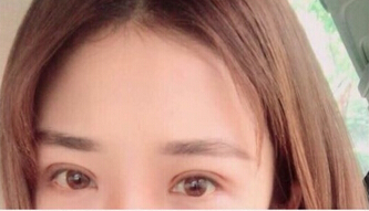山东济南眼科医院石晶主任做的眼睛的照片