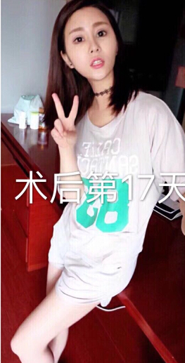 郑州金水周鹏飞医疗美容做的眼部手术修复