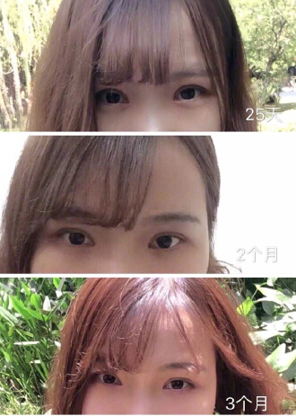 医学整形医院做双眼皮怎么样？