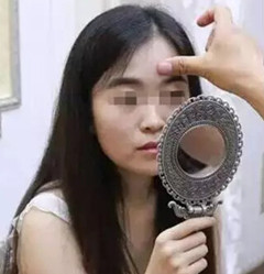 分享几个鼻部问题改良的案例