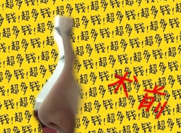 上海九院陈付国医生做的全肋骨鼻部手术