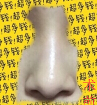 上海九院陈付国医生做的全肋骨鼻部手术