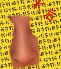 上海九院陈付国医生做的全肋骨鼻部手术