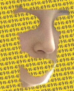 上海九院陈付国医生做的全肋骨鼻部手术