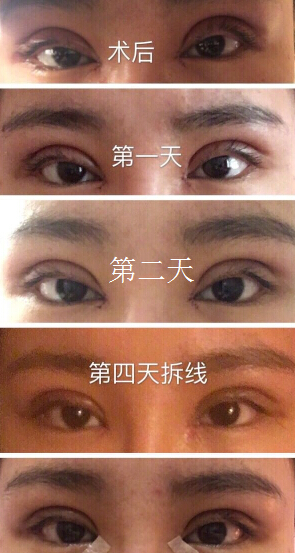 西安高一生整形医院怎么样?