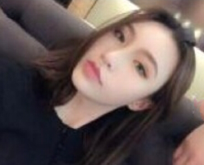 注射瘦脸术后果反馈