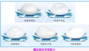 假体丰胸会不会爆裂?
