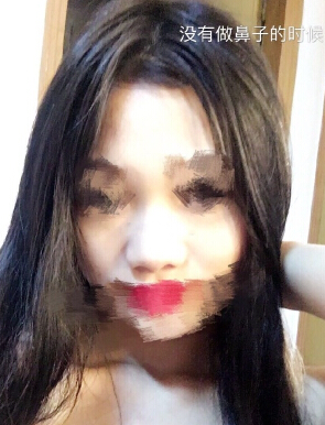 南京康美房志强主任做的鼻部手术手术案例