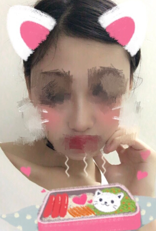 南京康美房志强主任做的鼻部手术手术案例
