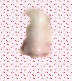 北京八大处王克明医生做的鼻部手术手术