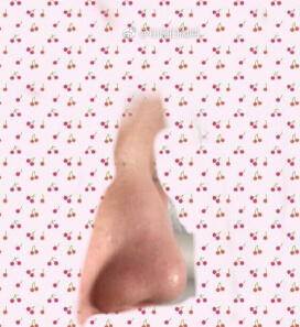 北京八大处王克明医生做的鼻部手术手术