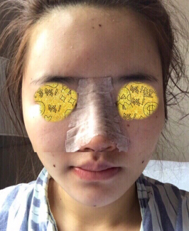 华颜黄富伟做的脂肪填充,贾德渊做的鼻部手术