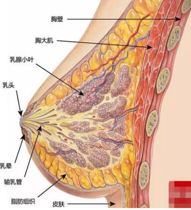 隆胸后，真胸和假胸可以鉴别吗？