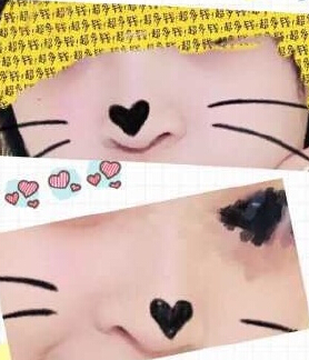 奕后整形美容医院鼻部手术手术案例