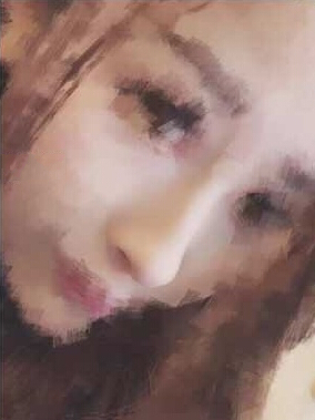 奕后整形美容医院鼻部手术手术案例