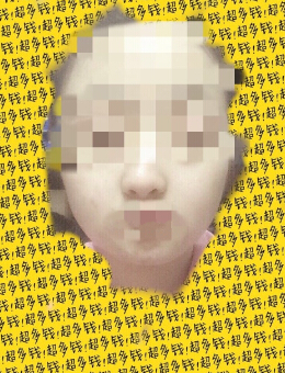 夏东胜的鼻子面诊反馈