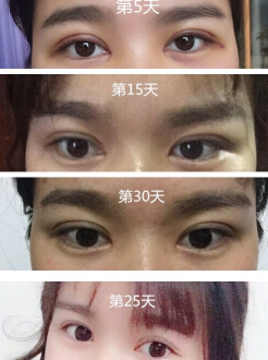 杭州优医联合医美周其光院长技术怎么样?