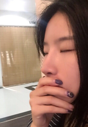 南宁美丽焦点整形焦俊光医生做的鼻部手术