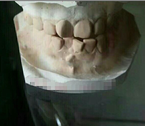 我想在这里说,我正畸的经验