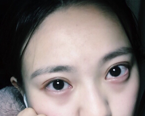 成都艺星刘晓荣院长手术果怎么样？