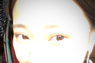 成都艺星刘晓荣院长手术果怎么样？
