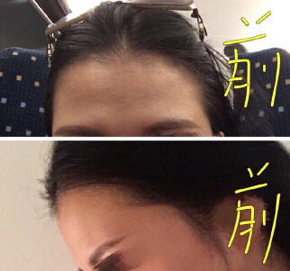 广州倍生医疗美容医院于建刚医生手术案例