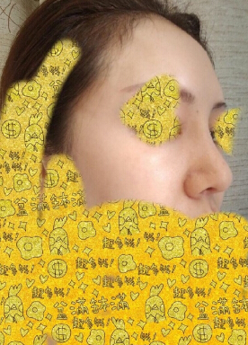 成都医美整形医院刘国权医生鼻部手术整形案例