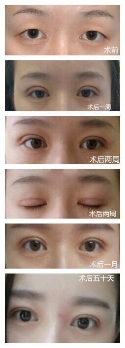 上海九院谢峰医生整形技术怎么样?