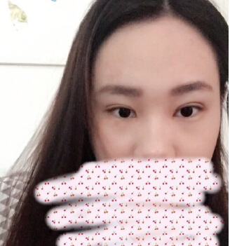 深圳市眼科医院叶琳医生手术果怎么样？