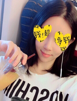 上海百达丽整形美容医院顾清医生手术案例