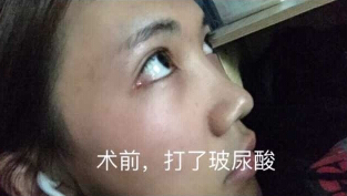 重庆联合丽格整形美容医院朱红振医生手术案例