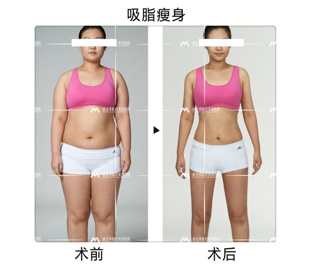 武汉新至美整形医院聂祝锋医生好不好?