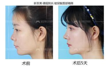 新至美医疗美容医院院长谭超怎么样?