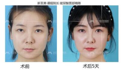 新至美医疗美容医院院长谭超怎么样?