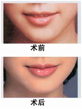 武汉新至美整形医院严海怎么样?