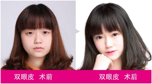 长沙雅美12周年庆--眼鼻特价活动