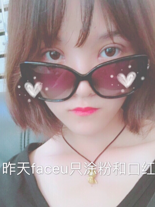 合肥华美赵院长做的韩式+开眼角