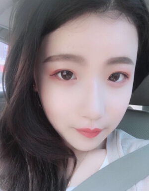 上海洁铭医疗美容门诊陈超群做的眼部手术