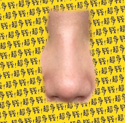 我的鼻子是不是做失败了呀?