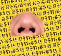 我的鼻子是不是做失败了呀?