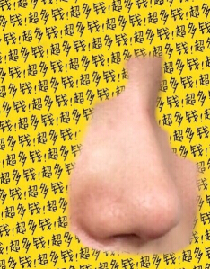我的鼻子是不是做失败了呀?