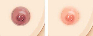 乳晕漂红哪种方法有