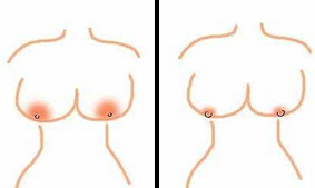 乳晕漂红哪种方法有