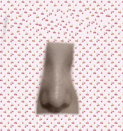 重庆时光陈玉莲的膨体+鼻中隔耳软骨+鼻小柱